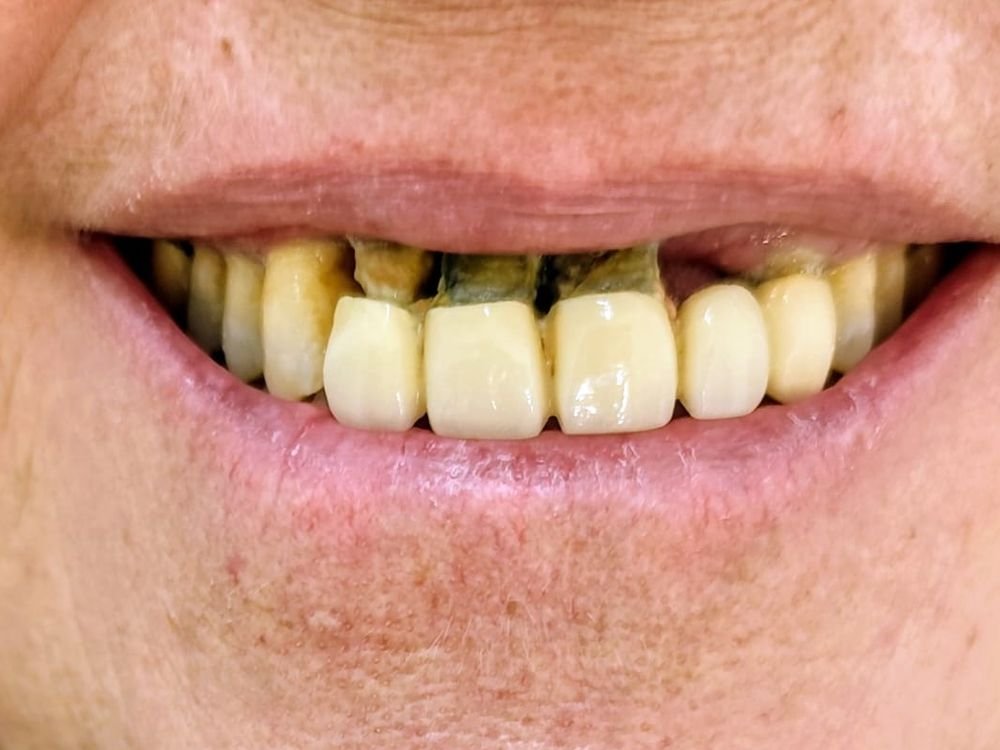 Sonrisa antes del tratamiento